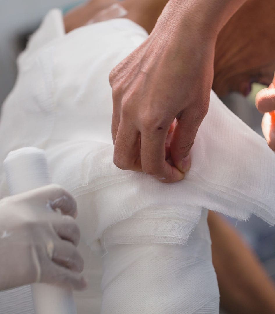 Burns Treatment by Dr Rory