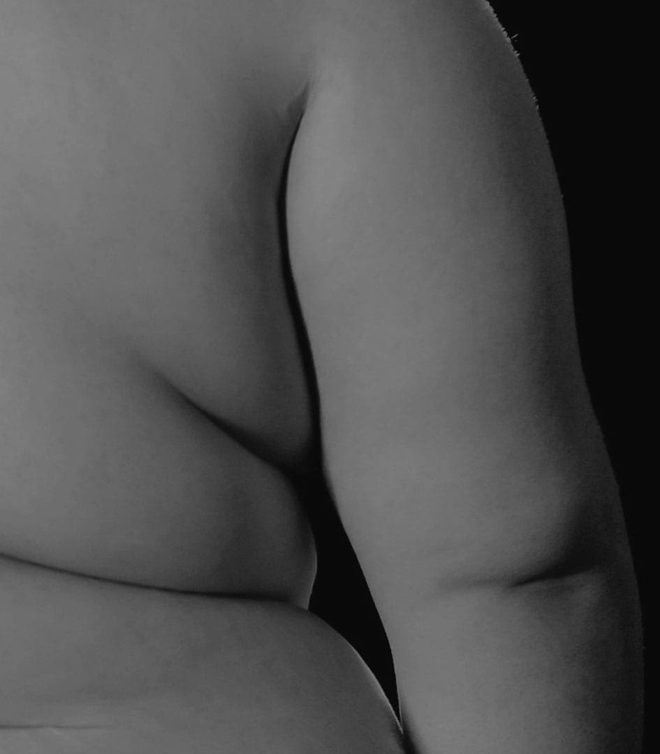 Upper Body Lift in Dubai